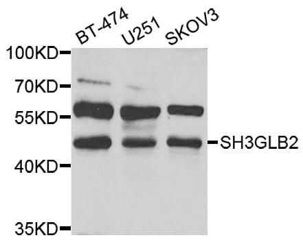 SH3GLB2 / Endophilin-B2 Antibody - Western blot analysis of extracts of various cell lines.