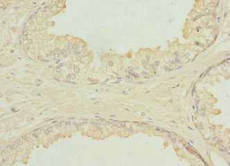 SH3GLB2 / Endophilin-B2 Antibody - Immunohistochemistry of paraffin-embedded human prostate tissue at dilution 1:100