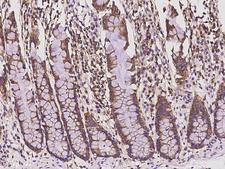 SH3GLB2 / Endophilin-B2 Antibody - Immunochemical staining of human SH3GLB2 in human rectum with rabbit polyclonal antibody at 1:100 dilution, formalin-fixed paraffin embedded sections.