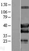 SH3GLB2 / Endophilin-B2 Protein - Western validation with an anti-DDK antibody * L: Control HEK293 lysate R: Over-expression lysate
