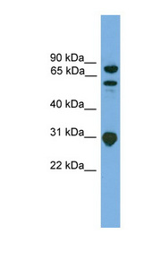 SH3KBP1 / CIN85 Antibody - SH3KBP1 antibody Western blot of Jurkat lysate. This image was taken for the unconjugated form of this product. Other forms have not been tested.