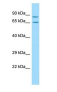 SH3KBP1 / CIN85 Antibody - SH3KBP1 / CIN85 antibody Western Blot of Rat Thymus.  This image was taken for the unconjugated form of this product. Other forms have not been tested.
