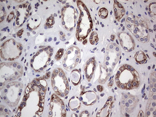 SH3P7 / HIP-55 Antibody - Immunohistochemical staining of paraffin-embedded Human Kidney tissue within the normal limits using anti-DBNL mouse monoclonal antibody. (Heat-induced epitope retrieval by 1 mM EDTA in 10mM Tris, pH8.5, 120C for 3min,