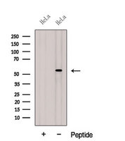 SH3P7 / HIP-55 Antibody - Western blot analysis of extracts of HeLa cells using DBNL antibody. The lane on the left was treated with blocking peptide.