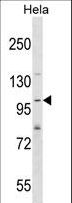 SH3PXD2A / TKS5 Antibody - SH3PXD2A Antibody western blot of HeLa cell line lysates (35 ug/lane). The SH3PXD2A antibody detected the SH3PXD2A protein (arrow).