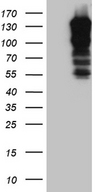 SH3PXD2A / TKS5 Antibody - HEK293T cells were transfected with the pCMV6-ENTRY control. (Left lane) or pCMV6-ENTRY SH3PXD2A. (Right lane) cDNA for 48 hrs and lysed. Equivalent amounts of cell lysates. (5 ug per lane) were separated by SDS-PAGE and immunoblotted with anti-SH3PXD2A. (1:2000)