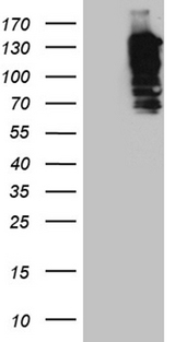 SH3PXD2A / TKS5 Antibody - HEK293T cells were transfected with the pCMV6-ENTRY control. (Left lane) or pCMV6-ENTRY SH3PXD2A. (Right lane) cDNA for 48 hrs and lysed. Equivalent amounts of cell lysates. (5 ug per lane) were separated by SDS-PAGE and immunoblotted with anti-SH3PXD2A. (1:2000)