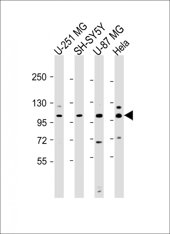 SH3PXD2B Antibody - All lanes: Anti-SH3PXD2B Antibody (Center) at 1:2000 dilution Lane 1: U-251 MG whole cell lysate Lane 2: SH-SY5Y whole cell lysate Lane 3: U-87 MG whole cell lysate Lane 4: Hela whole cell lysate Lysates/proteins at 20 µg per lane. Secondary Goat Anti-Rabbit IgG, (H+L), Peroxidase conjugated at 1/10000 dilution. Predicted band size: 102 kDa Blocking/Dilution buffer: 5% NFDM/TBST.