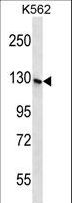 SH3TC1 Antibody - S3TC1 Antibody western blot of K562 cell line lysates (35 ug/lane). The S3TC1 antibody detected the S3TC1 protein (arrow).