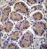 SH3TC1 Antibody - S3TC1 Antibody immunohistochemistry of formalin-fixed and paraffin-embedded human stomach tissue followed by peroxidase-conjugated secondary antibody and DAB staining.