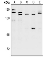 SH3TC1 Antibody - Western blot analysis of SH3TC1 expression in HEK293T (A), A549 (B), Hela (C), CT26 (D), C6 (E) whole cell lysates.