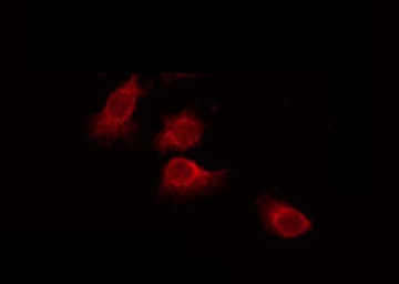 SH3TC1 Antibody - Staining HeLa cells by IF/ICC. The samples were fixed with PFA and permeabilized in 0.1% Triton X-100, then blocked in 10% serum for 45 min at 25°C. The primary antibody was diluted at 1:200 and incubated with the sample for 1 hour at 37°C. An Alexa Fluor 594 conjugated goat anti-rabbit IgG (H+L) Ab, diluted at 1/600, was used as the secondary antibody.