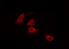 SH3TC1 Antibody - Staining HeLa cells by IF/ICC. The samples were fixed with PFA and permeabilized in 0.1% Triton X-100, then blocked in 10% serum for 45 min at 25°C. The primary antibody was diluted at 1:200 and incubated with the sample for 1 hour at 37°C. An Alexa Fluor 594 conjugated goat anti-rabbit IgG (H+L) Ab, diluted at 1/600, was used as the secondary antibody.