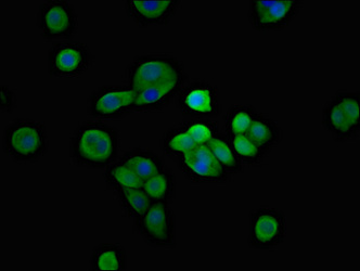 SH3TC2 Antibody - Immunofluorescent analysis of PC3 cells at a dilution of 1:100 and Alexa Fluor 488-congugated AffiniPure Goat Anti-Rabbit IgG(H+L)