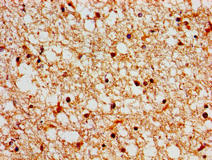 SH3TC2 Antibody - Immunohistochemistry image of paraffin-embedded human brain tissue at a dilution of 1:100