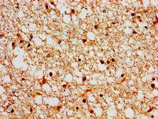 SH3TC2 Antibody - Immunohistochemistry image of paraffin-embedded human brain tissue at a dilution of 1:100