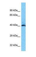 SH3YL1 Antibody - Western blot of SH3YL1 Antibody with human Fetal Lung lysate.  This image was taken for the unconjugated form of this product. Other forms have not been tested.
