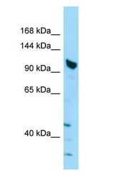 SHANK2 / SHANK Antibody - SHANK2 / SHANK antibody Western Blot of ACHN.  This image was taken for the unconjugated form of this product. Other forms have not been tested.