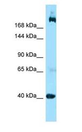 SHANK2 / SHANK Antibody - SHANK2 / SHANK antibody Western Blot of Jurkat.  This image was taken for the unconjugated form of this product. Other forms have not been tested.