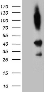 SHARPIN Antibody - HEK293T cells were transfected with the pCMV6-ENTRY control. (Left lane) or pCMV6-ENTRY SHARPIN. (Right lane) cDNA for 48 hrs and lysed