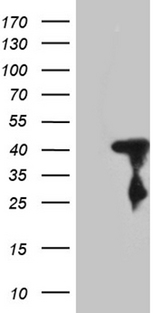 SHARPIN Antibody - HEK293T cells were transfected with the pCMV6-ENTRY control. (Left lane) or pCMV6-ENTRY SHARPIN. (Right lane) cDNA for 48 hrs and lysed. Equivalent amounts of cell lysates. (5 ug per lane) were separated by SDS-PAGE and immunoblotted with anti-SHARPIN. (1:2000)