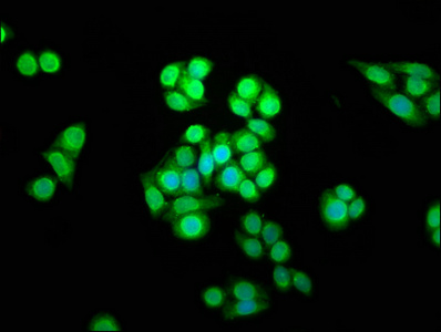 SHARPIN Antibody - Immunofluorescence staining of PC3 cells at a dilution of 1:166, counter-stained with DAPI. The cells were fixed in 4% formaldehyde, permeabilized using 0.2% Triton X-100 and blocked in 10% normal Goat Serum. The cells were then incubated with the antibody overnight at 4°C.The secondary antibody was Alexa Fluor 488-congugated AffiniPure Goat Anti-Rabbit IgG (H+L) .