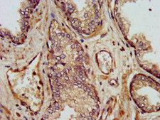 SHARPIN Antibody - Immunohistochemistry image at a dilution of 1:500 and staining in paraffin-embedded human prostate tissueÃƒÆ’Ã†€™ § €š¬Ã…¾ ¢ÃƒÆ’ ‚¬¦ €š¬ €ž¢ performed on a Leica BondTM system. After dewaxing and hydration, antigen retrieval was mediated by high pressure in a citrate buffer (pH 6.0) . Section was blocked with 10% normal goat serum 30min at RT. Then primary antibody (1% BSA) was incubated at 4 °C overnight. The primary is detected by a biotinylated secondary antibody and visualized using an HRP conjugated SP system.