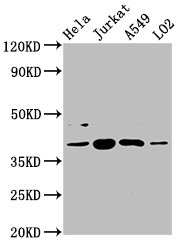 SHARPIN Antibody - Positive Western Blot detected in Hela whole cell lysate, Jurkat whole cell lysate, A549 whole cell lysate, LO2 whole cell lysate. All lanes: SHARPIN antibody at 5.4 µg/ml Secondary Goat polyclonal to rabbit IgG at 1/50000 dilution. Predicted band size: 40, 34 KDa. Observed band size: 40 KDa