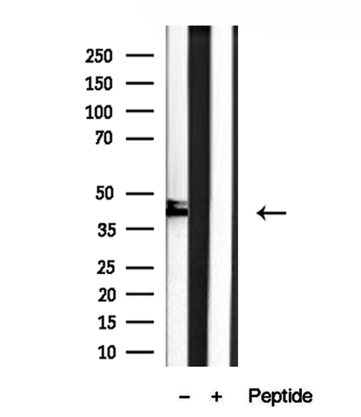 SHARPIN Antibody - Western blot analysis of extracts of Raji cells using SHARPIN antibody.