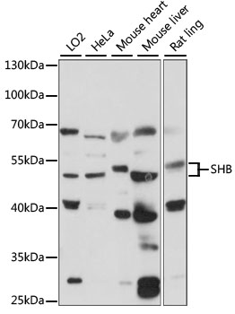 SHB Antibody - Western blot analysis of extracts of various cell lines, using SHB antibody at 1:1000 dilution. The secondary antibody used was an HRP Goat Anti-Rabbit IgG (H+L) at 1:10000 dilution. Lysates were loaded 25ug per lane and 3% nonfat dry milk in TBST was used for blocking. An ECL Kit was used for detection and the exposure time was 90s.