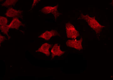 SHB Antibody - Staining HuvEc cells by IF/ICC. The samples were fixed with PFA and permeabilized in 0.1% Triton X-100, then blocked in 10% serum for 45 min at 25°C. The primary antibody was diluted at 1:200 and incubated with the sample for 1 hour at 37°C. An Alexa Fluor 594 conjugated goat anti-rabbit IgG (H+L) Ab, diluted at 1/600, was used as the secondary antibody.