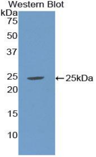 SHBG Antibody - Western blot of recombinant SHBG.  This image was taken for the unconjugated form of this product. Other forms have not been tested.