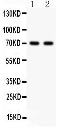 SHBG Antibody - SHBG antibody Western blot. All lanes: Anti SHBG at 0.5 ug/ml. Lane 1: HELA Whole Cell Lysate at 40 ug. Lane 2: COLO320 Whole Cell Lysate at 40 ug. Predicted band size: 44 kD. Observed band size: 70 kD.