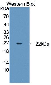 SHBG Antibody - Western blot of SHBG antibody.