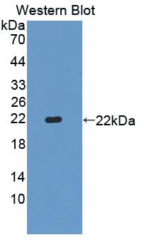 SHBG Antibody - Western blot of SHBG antibody.