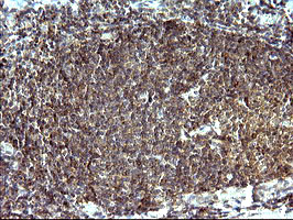 SHBG Antibody - IHC of paraffin-embedded Human lymph node tissue using anti-SHBG mouse monoclonal antibody. (Heat-induced epitope retrieval by 10mM citric buffer, pH6.0, 120°C for 3min).
