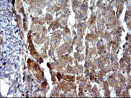 SHBG Antibody - IHC of paraffin-embedded Human liver tissue using anti-SHBG mouse monoclonal antibody. (Heat-induced epitope retrieval by 10mM citric buffer, pH6.0, 120°C for 3min).