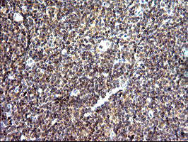 SHBG Antibody - IHC of paraffin-embedded Human lymph node tissue using anti-SHBG mouse monoclonal antibody. (Heat-induced epitope retrieval by 10mM citric buffer, pH6.0, 120°C for 3min).
