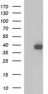 SHBG Antibody - HEK293T cells were transfected with the pCMV6-ENTRY control (Left lane) or pCMV6-ENTRY SHBG (Right lane) cDNA for 48 hrs and lysed. Equivalent amounts of cell lysates (5 ug per lane) were separated by SDS-PAGE and immunoblotted with anti-SHBG.