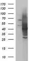 SHBG Antibody - HEK293T cells were transfected with the pCMV6-ENTRY control (Left lane) or pCMV6-ENTRY SHBG (Right lane) cDNA for 48 hrs and lysed. Equivalent amounts of cell lysates (5 ug per lane) were separated by SDS-PAGE and immunoblotted with anti-SHBG.