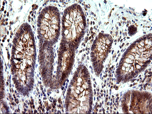 SHBG Antibody - IHC of paraffin-embedded Human colon tissue using anti-SHBG mouse monoclonal antibody. (Heat-induced epitope retrieval by 10mM citric buffer, pH6.0, 120°C for 3min).