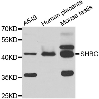 SHBG Antibody - Western blot analysis of extracts of various cell lines.