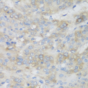 SHBG Antibody - Immunohistochemistry of paraffin-embedded human liver tissue.