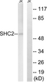 SHC2 / SLI Antibody - Western blot analysis of lysates from Jurkat cells, using SHC2 Antibody. The lane on the right is blocked with the synthesized peptide.