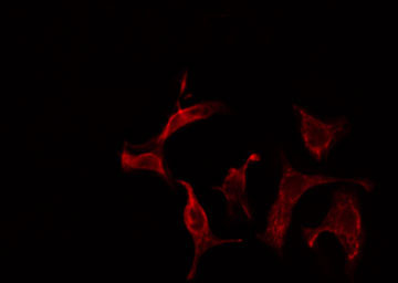 SHC2 / SLI Antibody - Staining HeLa cells by IF/ICC. The samples were fixed with PFA and permeabilized in 0.1% Triton X-100, then blocked in 10% serum for 45 min at 25°C. The primary antibody was diluted at 1:200 and incubated with the sample for 1 hour at 37°C. An Alexa Fluor 594 conjugated goat anti-rabbit IgG (H+L) antibody, diluted at 1/600, was used as secondary antibody.
