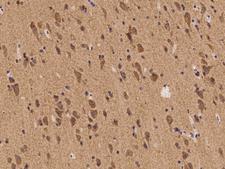 SHC2 / SLI Antibody - Immunochemical staining of human SHC2 in human brain with rabbit polyclonal antibody at 1:100 dilution, formalin-fixed paraffin embedded sections.