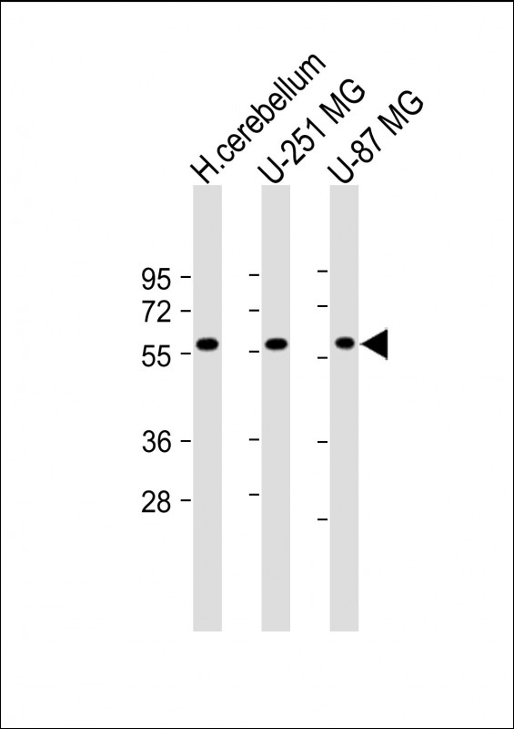 SHC2 / SLI Antibody - All lanes: Anti-SHC2 Antibody (N-Term) at 1:2000 dilution Lane 1: Human cerebellum lysate Lane 2: U-251 MG whole cell lysate Lane 3: U-87 MG whole cell lysate Lysates/proteins at 20 µg per lane. Secondary Goat Anti-Rabbit IgG, (H+L), Peroxidase conjugated at 1/10000 dilution. Predicted band size: 62 kDa Blocking/Dilution buffer: 5% NFDM/TBST.