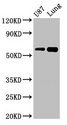 SHC3 / SHCC Antibody - Positive Western Blot detected in U87 whole cell lysate, Mouse lung tissue. All lanes: SHC3 antibody at 3 µg/ml Secondary Goat polyclonal to rabbit IgG at 1/50000 dilution. Predicted band size: 65, 52 KDa. Observed band size: 65 KDa