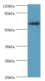 SHC4 Antibody - Western blot. All lanes: SHC4 antibody at 6 ug/ml+Jurkat whole cell lysate. Secondary antibody: Goat polyclonal to rabbit at 1:10000 dilution. Predicted band size: 69 kDa. Observed band size: 69 kDa.