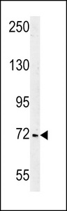 SHCBP1 Antibody - SHCBP1 Antibody western blot of Jurkat cell line lysates (35 ug/lane). The SHCBP1 antibody detected the SHCBP1 protein (arrow).
